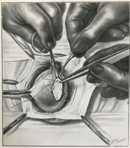 xenoimplantes